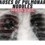 Causes of Pulmonary Nodules Mnemonic