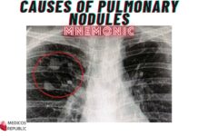 Causes of Pulmonary Nodules Mnemonic