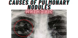 Causes of Pulmonary Nodules Mnemonic