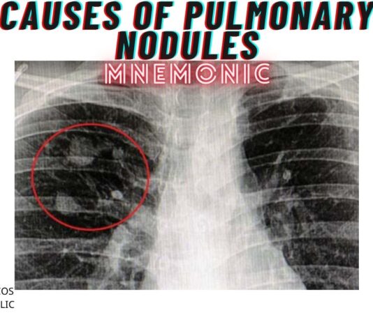 Causes of Pulmonary Nodules Mnemonic