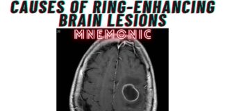 Causes of Ring-Enhancing Brain Lesions