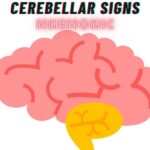 Cerebellar Signs Mnemonic