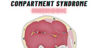 Compartment Syndrome Mnemonic – "5 P’s"