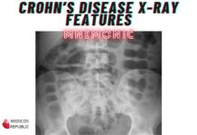 Crohn’s disease X-Ray Features Mnemonic