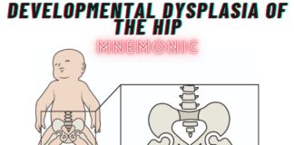 Developmental Dysplasia of the Hip Mnemonic