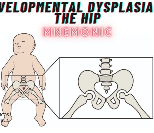 Developmental Dysplasia of the Hip Mnemonic