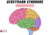 Gerstmann Syndrome Features Mnemonic