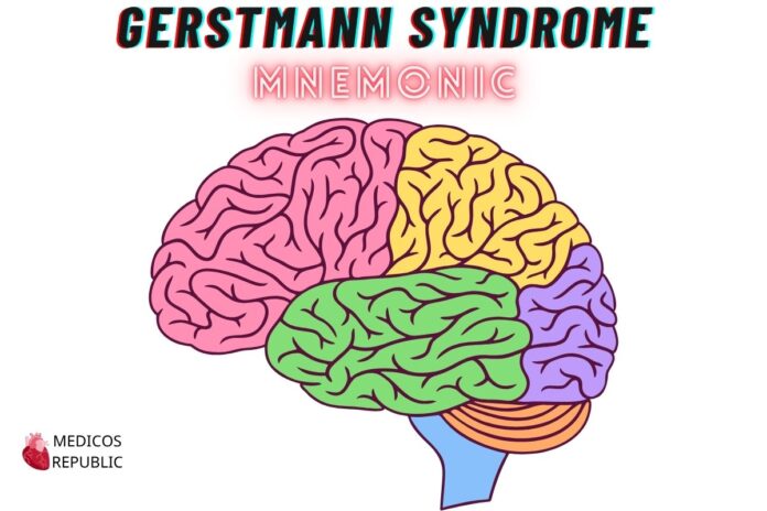 Gerstmann Syndrome Features Mnemonic