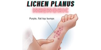 Lichen Planus Mnemonic: "6 P's"