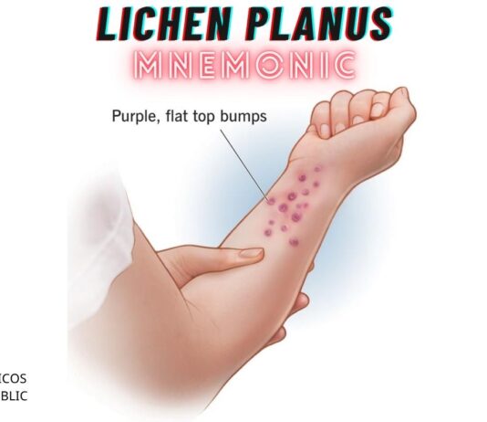 Lichen Planus Mnemonic: “6 P’s” Lichen Planus Mnemonic: "6 P's"