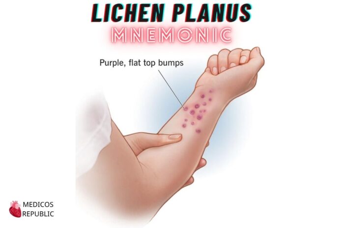 Lichen Planus Mnemonic: 