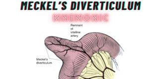 Meckel’s Diverticulum Mnemonic