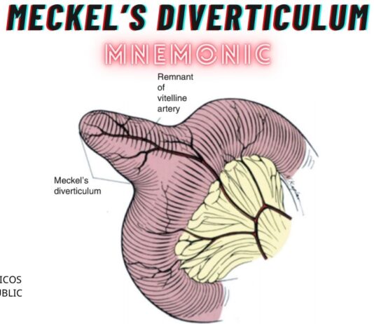 Meckel’s Diverticulum Mnemonic