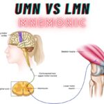 Mnemonic to Differentiate Upper vs Lower Motor Neuron Lesions