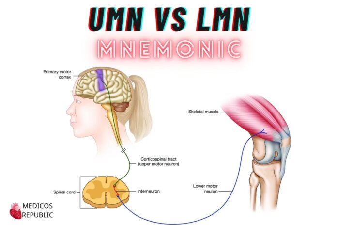 Mnemonic to Differentiate Upper vs Lower Motor Neuron Lesions