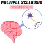 Multiple Sclerosis Symptoms Mnemonic