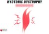 Myotonic Dystrophy Mnemonic