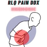 RLQ Pain DDx Mnemonic