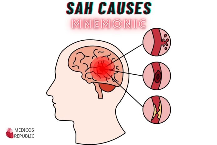Subarachnoid Hemorrhage Causes Mnemonic