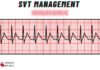 SVT Management Mnemonic