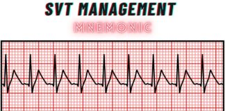 SVT Management Mnemonic
